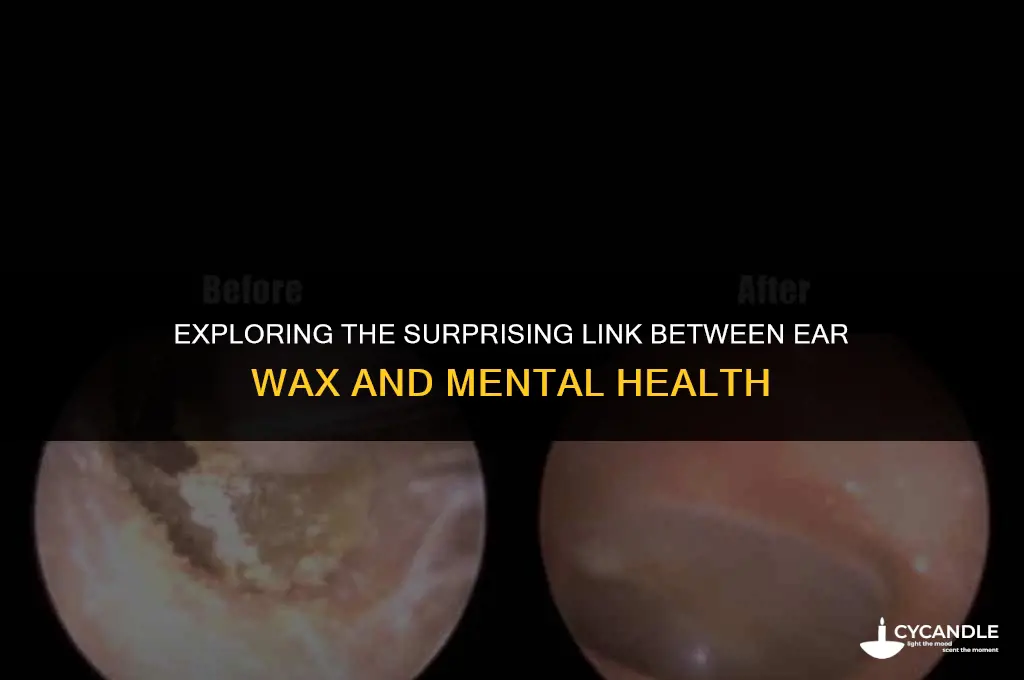 can ear wax cause mental health problems