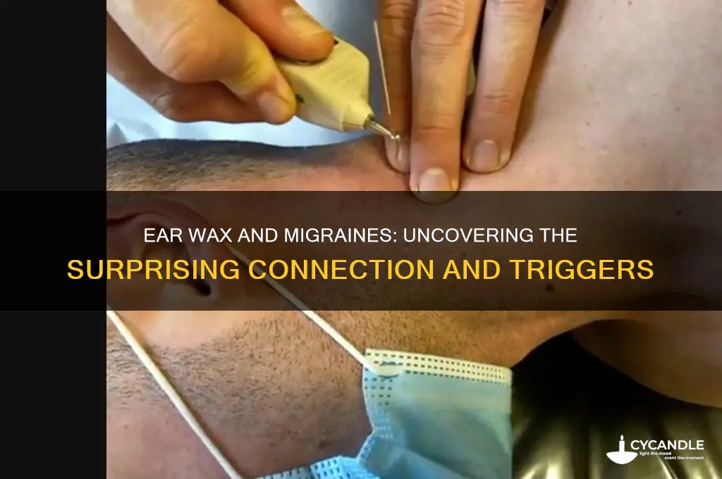 can ear wax cause migraines