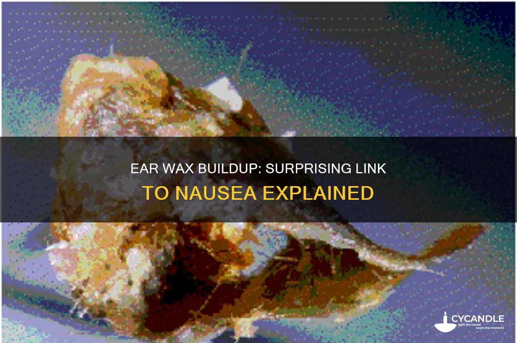 can ear wax cause nausea
