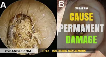 Can Ear Wax Cause Permanent Damage? Facts and Prevention Tips