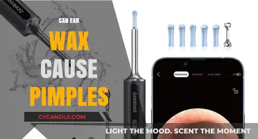 Ear Wax and Acne: Unraveling the Surprising Connection
