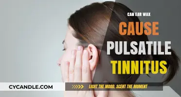 Exploring the Link: Can Ear Wax Cause Pulsatile Tinnitus?