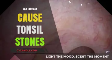 Ear Wax and Tonsil Stones: Unlikely Connection or Hidden Cause?