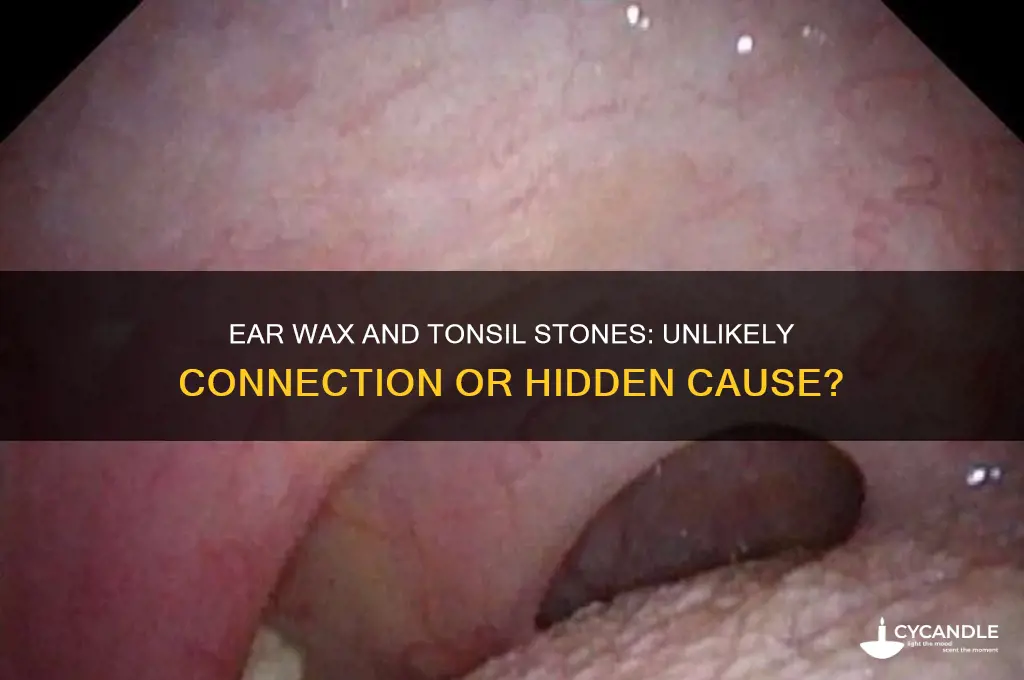 can ear wax cause tonsil stones