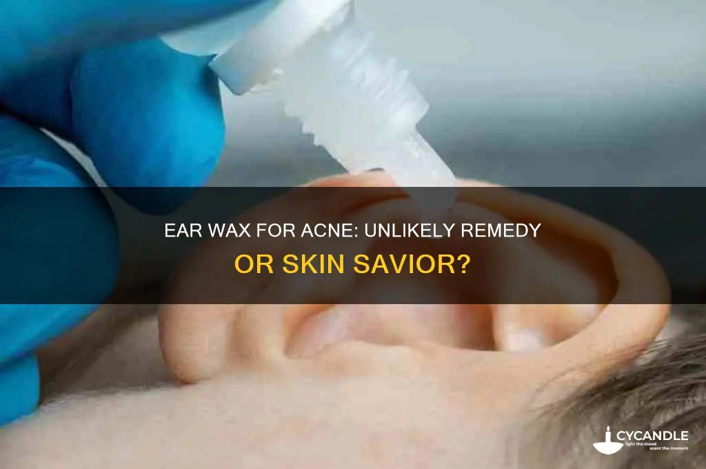 can ear wax cure acne