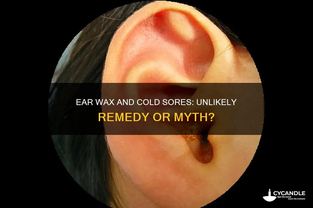 can ear wax cure cold sores