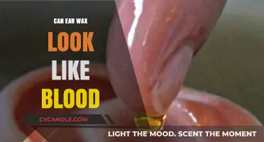 Is It Blood or Ear Wax? Understanding Unusual Ear Discharge