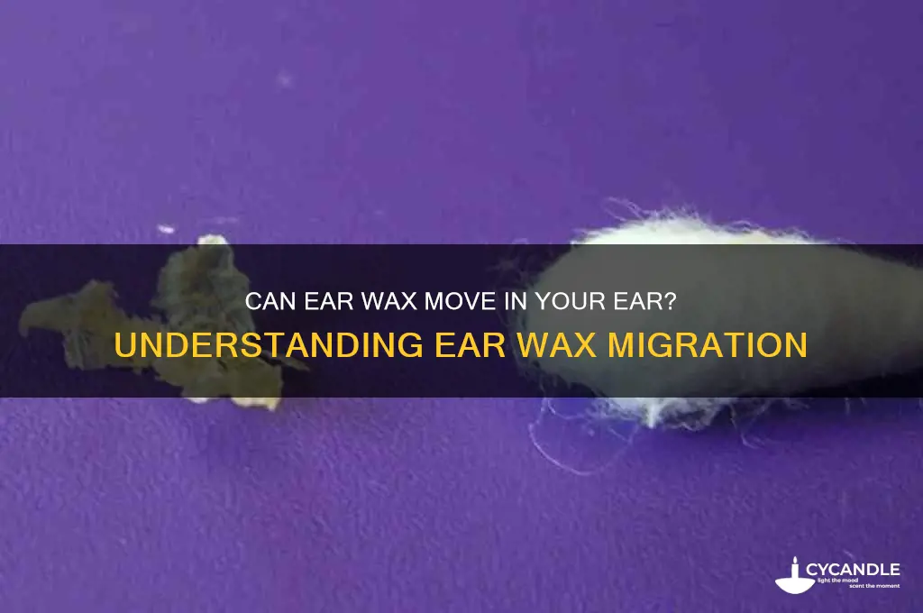 can ear wax move in your ear