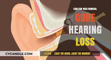 Can Ear Wax Removal Restore Hearing Loss? Facts and Insights