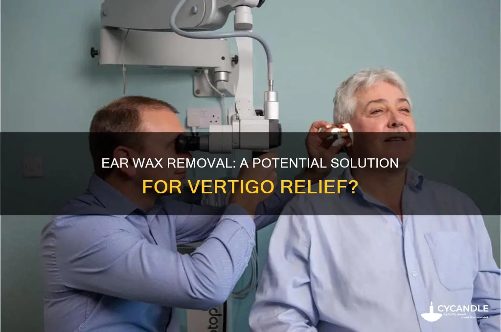can ear wax removal help vertigo