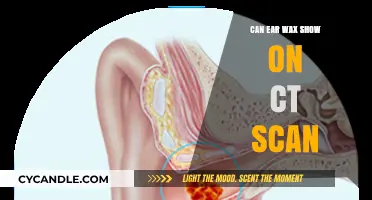 Can Ear Wax Be Detected on a CT Scan?