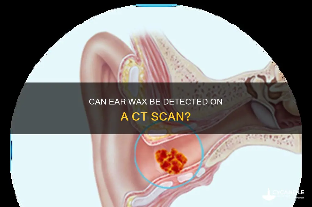 can ear wax show on ct scan