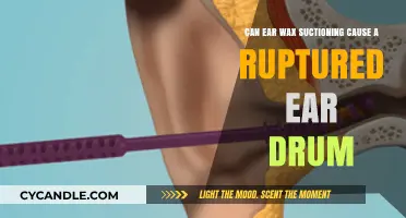 Ear Wax Suction Risks: Can It Lead to a Ruptured Eardrum?