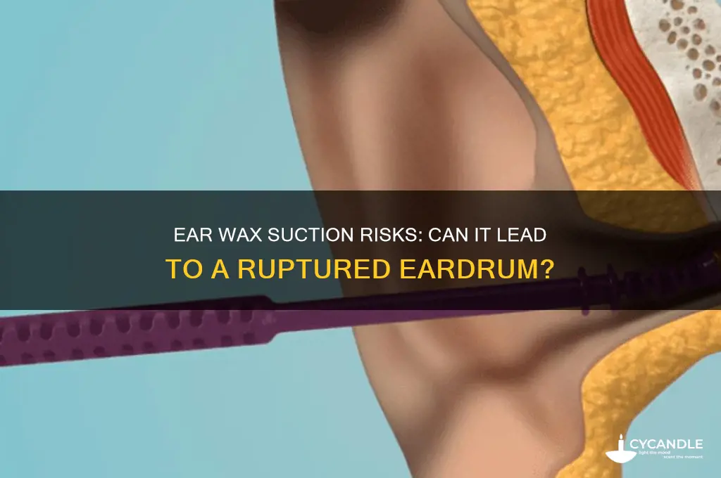can ear wax suctioning cause a ruptured ear drum