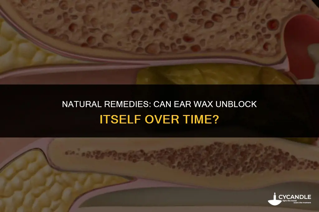 can ear wax unblock itself