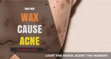Unveiling the Truth: Does Face Wax Trigger Acne Breakouts?