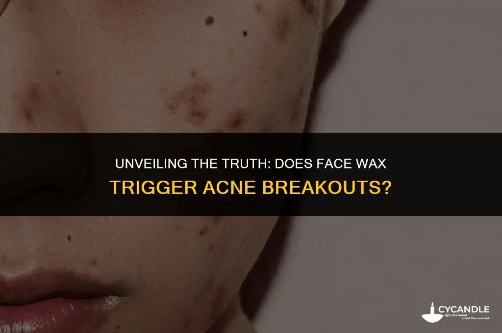 can face wax cause acne