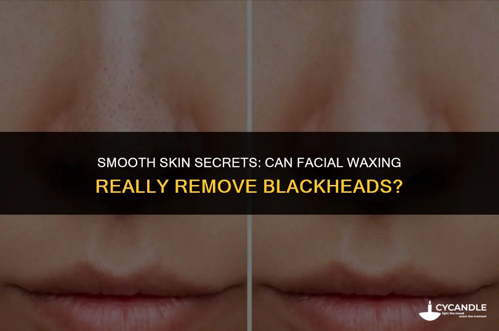 can facial wax removal blackheads