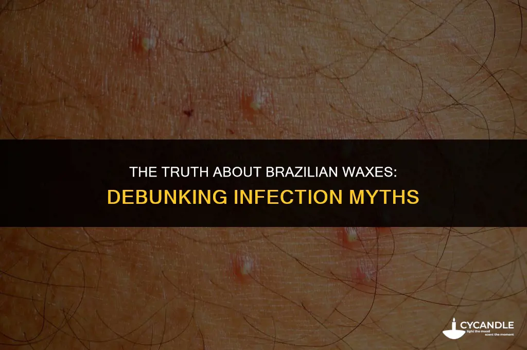can getting a brazilian wax cause infections