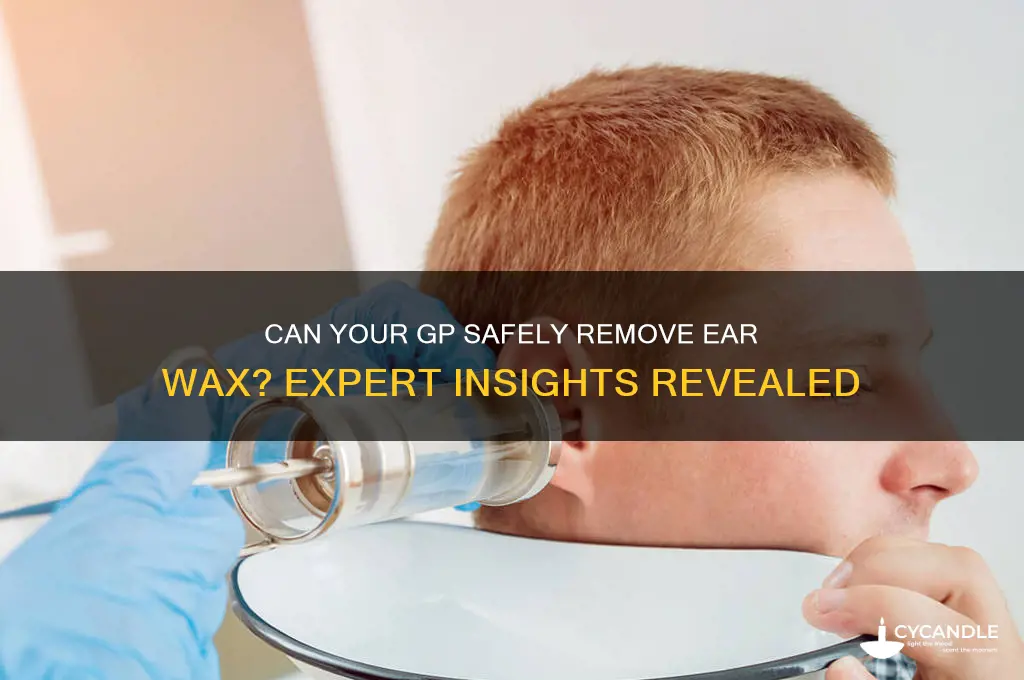 can gp clean ear wax