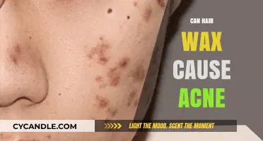 Unveiling the Truth: Does Hair Wax Trigger Acne Breakouts?