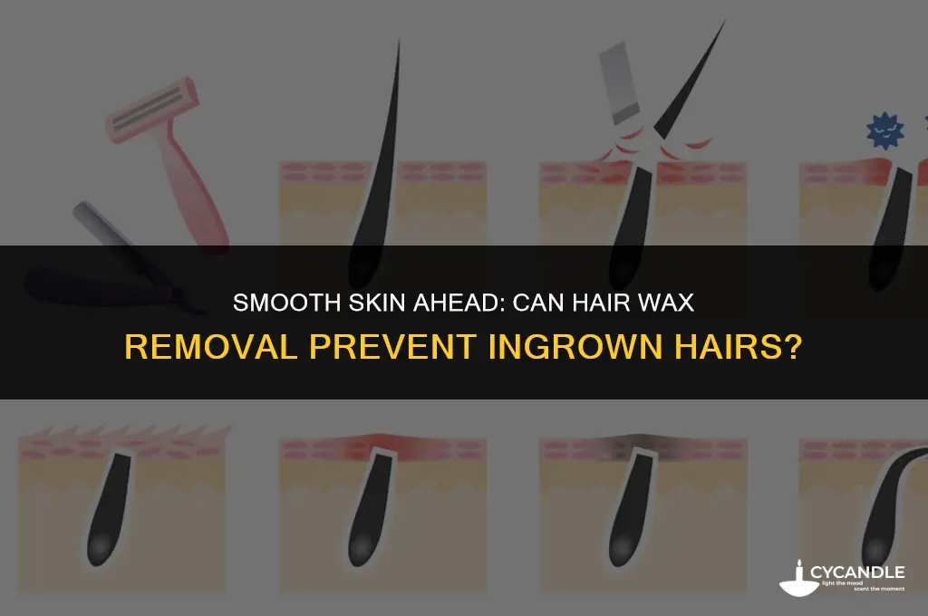 can hair wax removal stop ingrown hairs