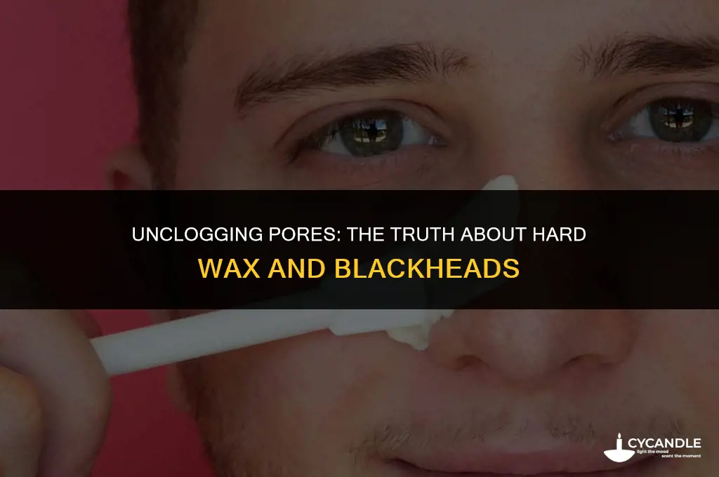 can hard wax pull out blackheads