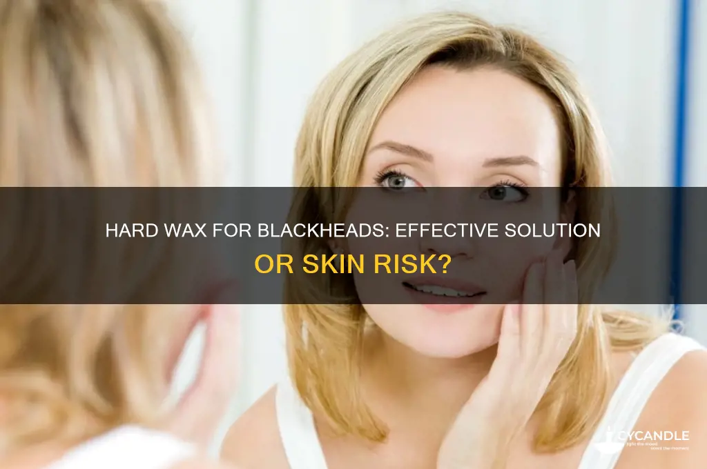 can hard wax remove blackheads