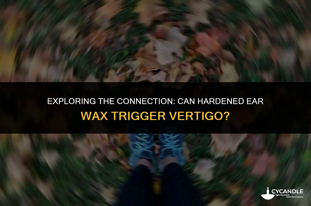 can hardened ear wax cause vertigo