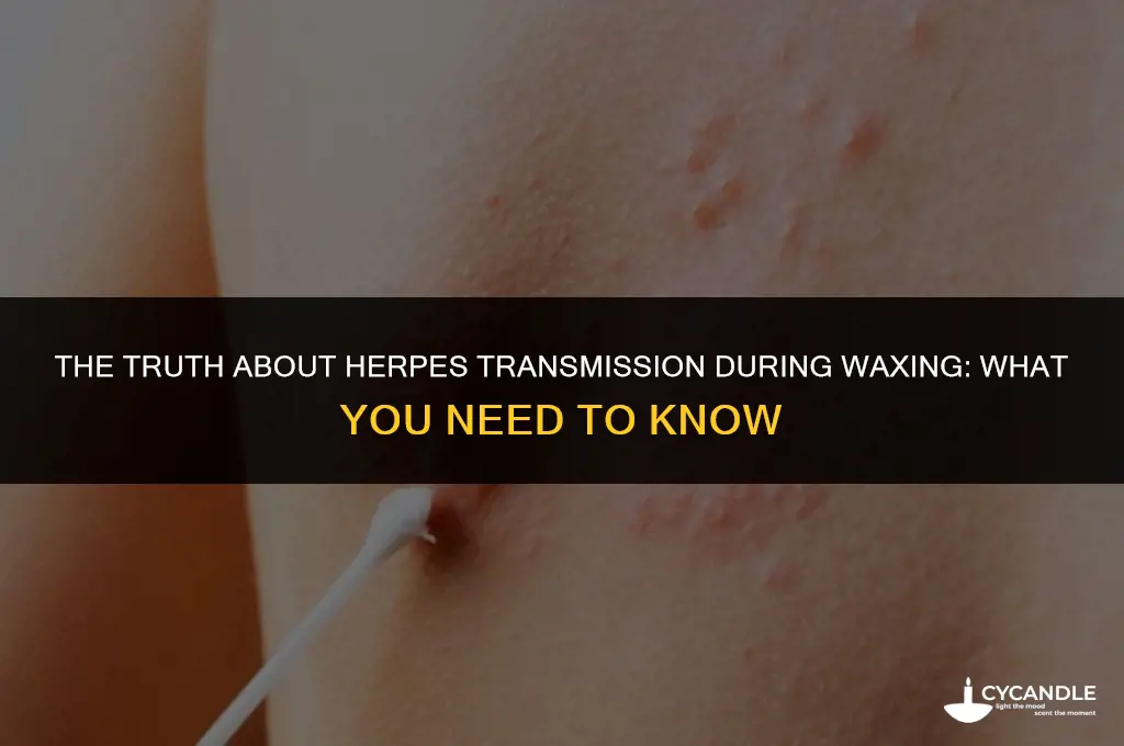 can herpes be passed through waxing