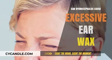 Hydrocephalus and Ear Wax: Unraveling the Unexpected Connection