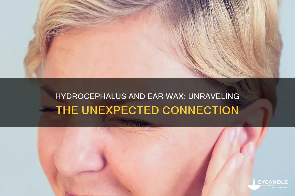 can hydrocephalus cause excessive ear wax
