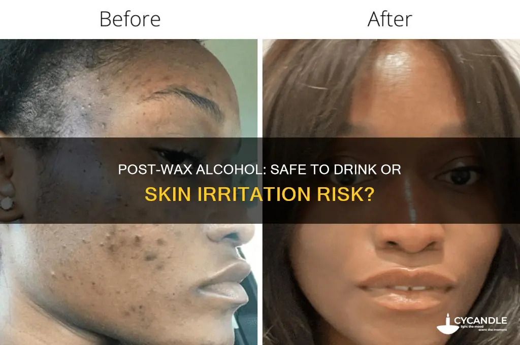 can i drink alcohol after waxing
