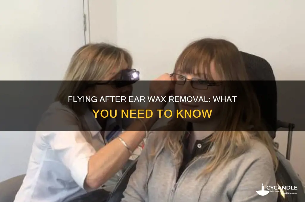 can i fly after ear wax removal