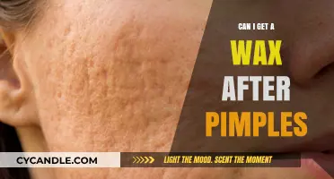 Waxing After Pimples: Safe Practices and Skin Care Tips