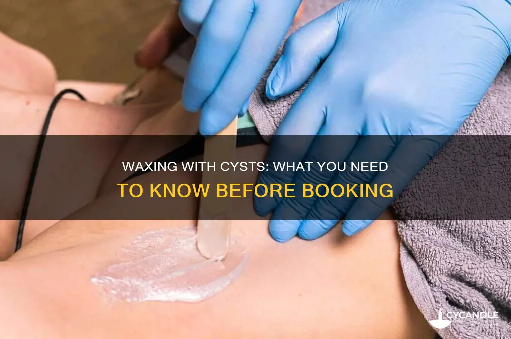 can i get a wax if i have a cyst