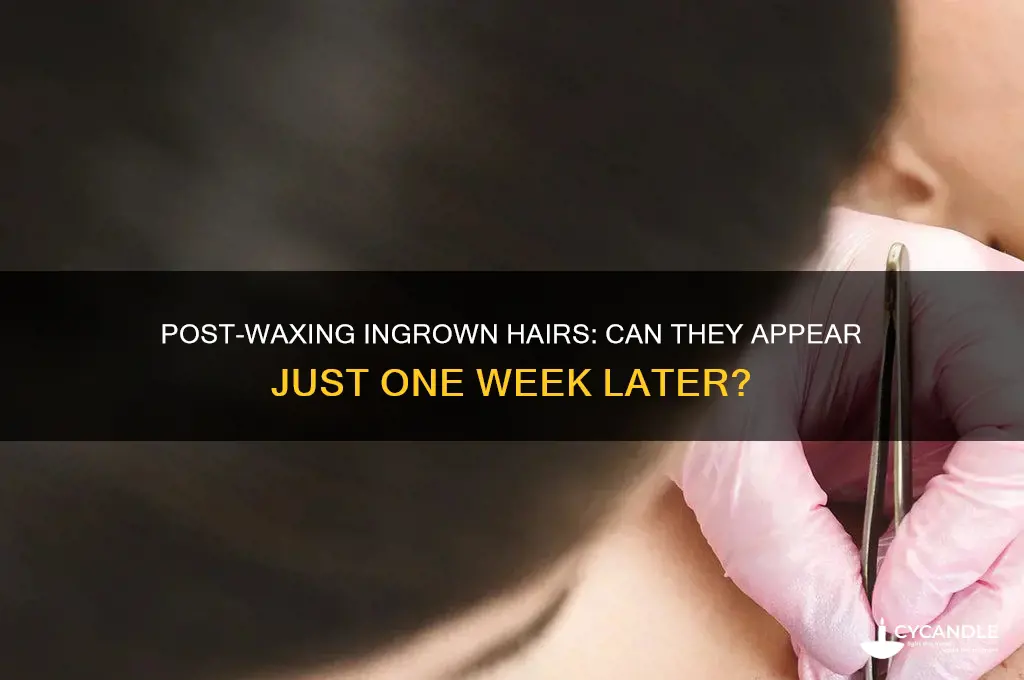 can i get ingrowns a week after waxing