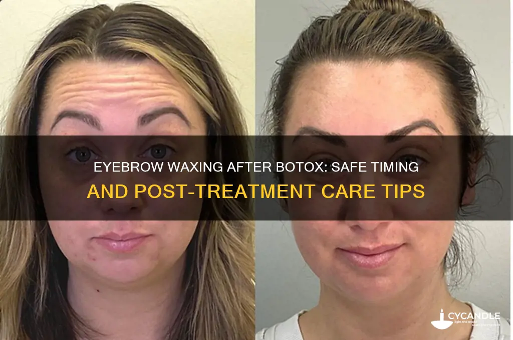 can i get my eyebrows waxed after botox