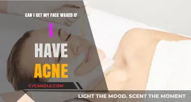 Face Waxing with Acne: Safe or Risky? Expert Advice