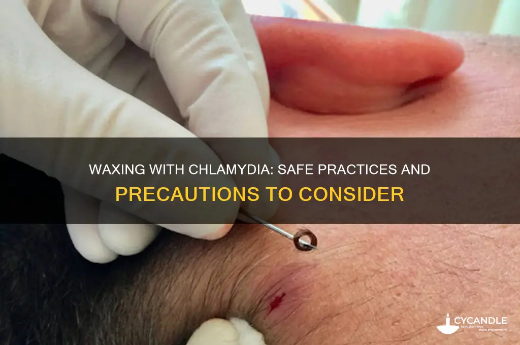 can i get waxed if i have chlamydia