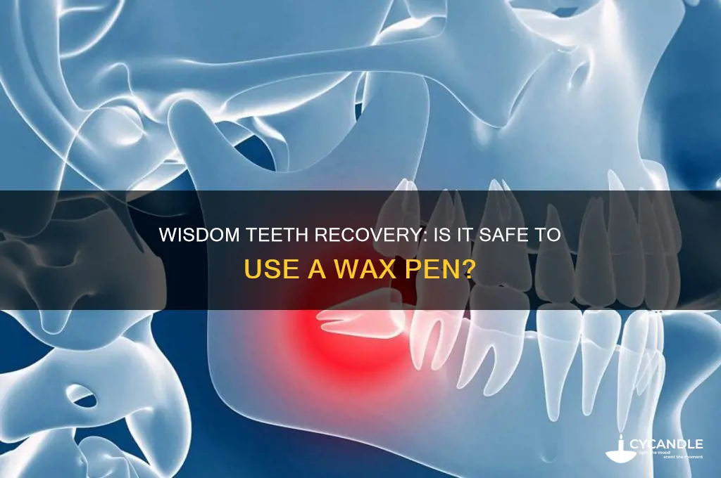 can i hit my wax pen after wisdom teeth removal