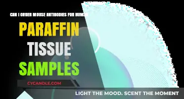 Using Mouse Antibodies for Human Paraffin Tissue Samples: Ordering Guide