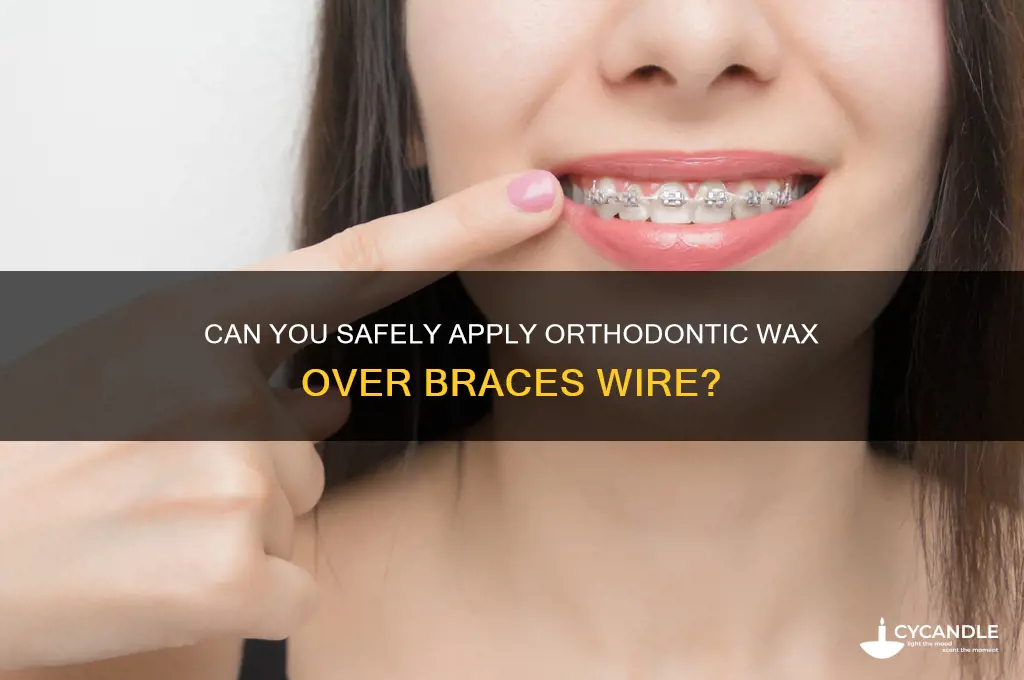can i put orthodontic wax over a braces wire