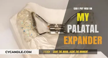 Wax on Palatal Expander: Safe Application Tips and Advice