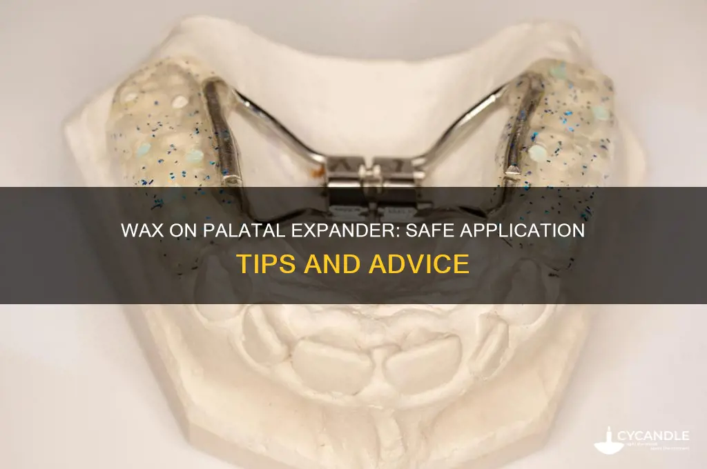 can i put wax on my palatal expander