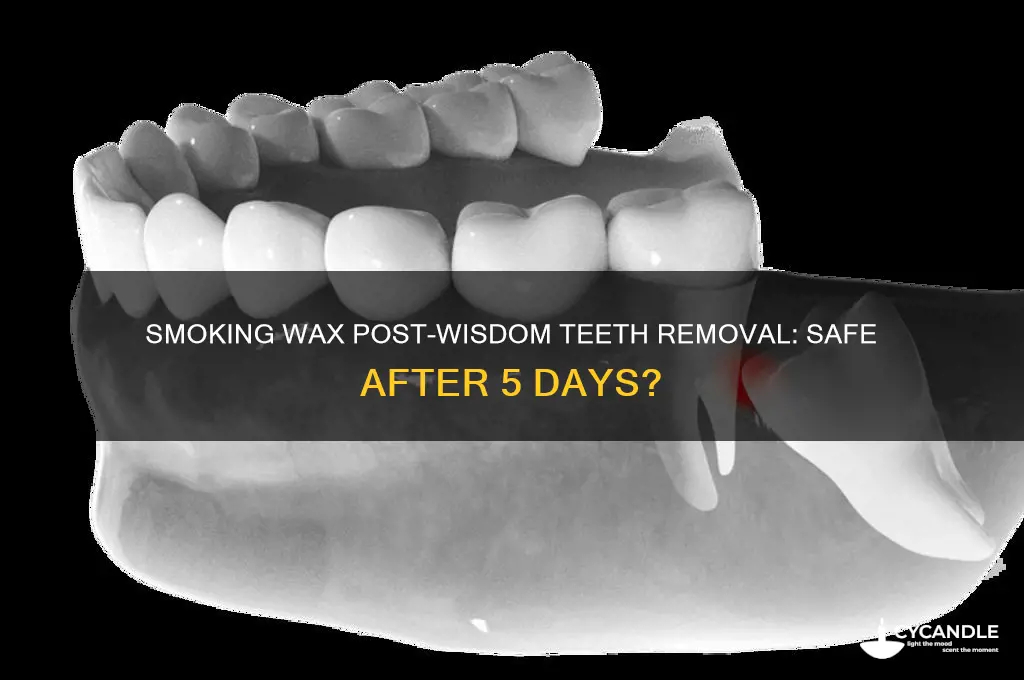 can i smoke 5 wax days after wisdom teeth removal