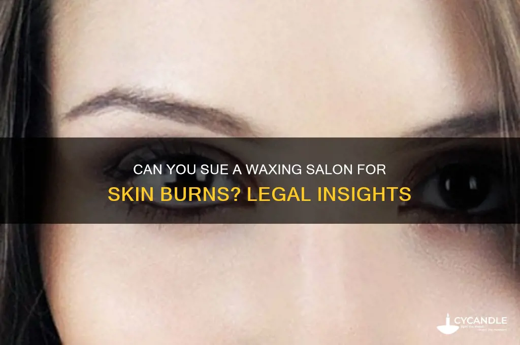 can i sue a waxing place for burning my skin