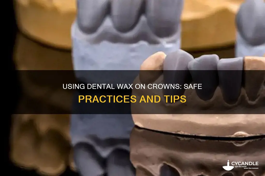 can i use dental wax on crowns