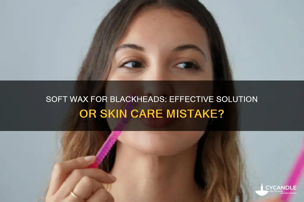 can i use soft wax for blackheads