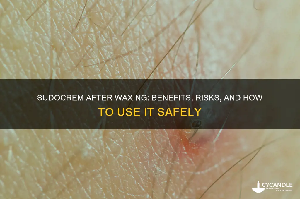 can i use sudocrem after waxing